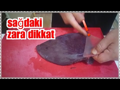 ASLA CİĞERE BIÇAK DEĞDİRME SAĞLIKLI BAKTERİ ZARIN ALTINDA