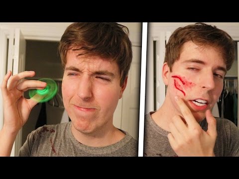 Fidget Spinner Vs Face Legit Had To Get Stitches