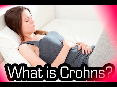 What Is Crohns Disease